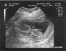 ultrasound_2 * 2640 x 2040 * (1.34MB)